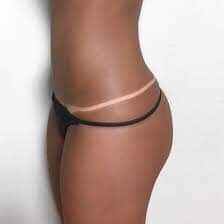 Rapid Custom Spray TAN