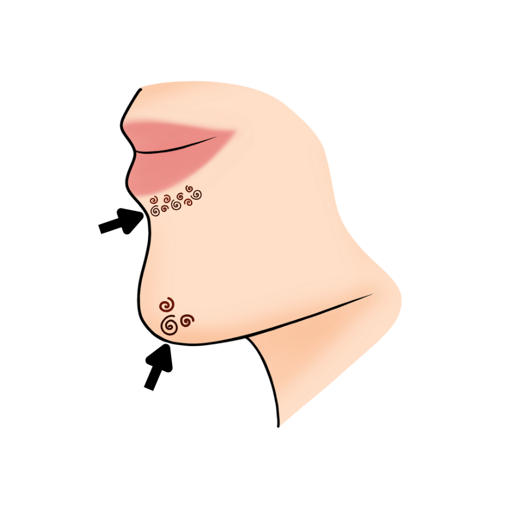 Chin + Lip Lower