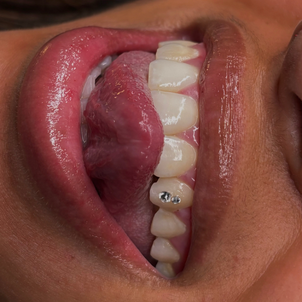 Swarovski Crystal Tooth Gem at planet HER in Alexandria, IN
