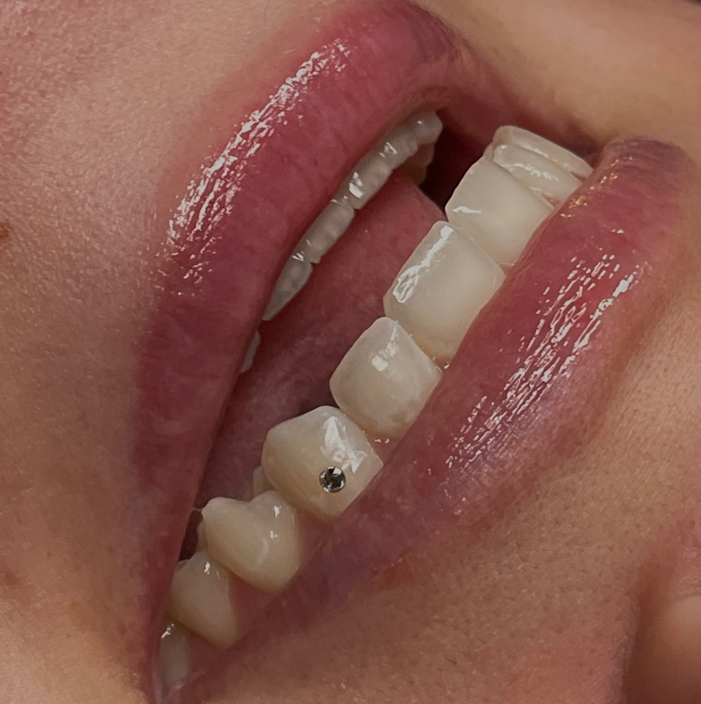 Swarovski Crystal Tooth Gem