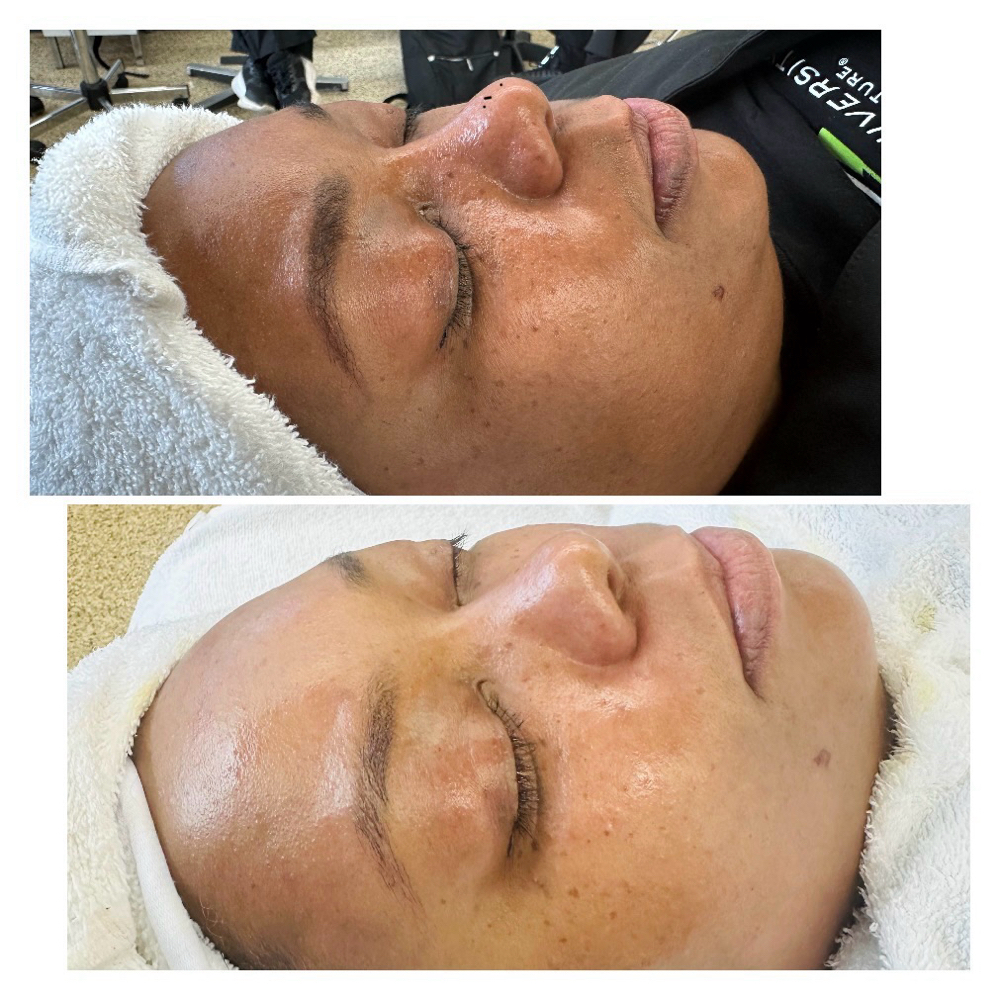 Pro Dermaplaning at Saba's De Beaute in Chicago, IL