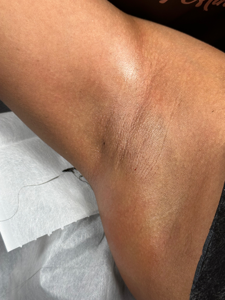 Underarm Wax