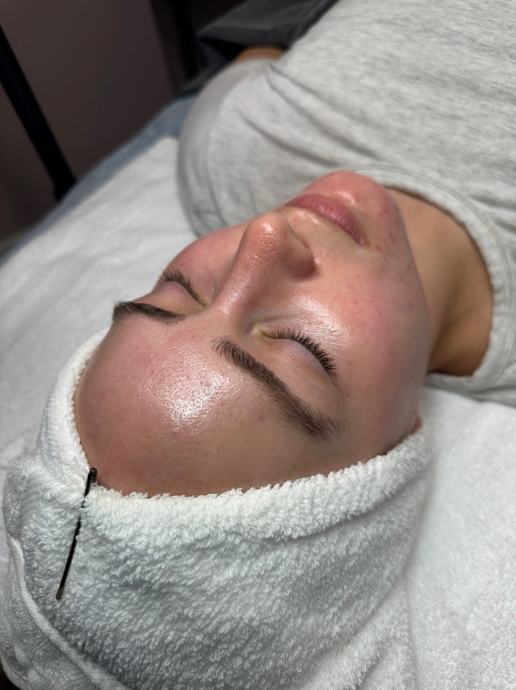 Oxygen Glow Facial
