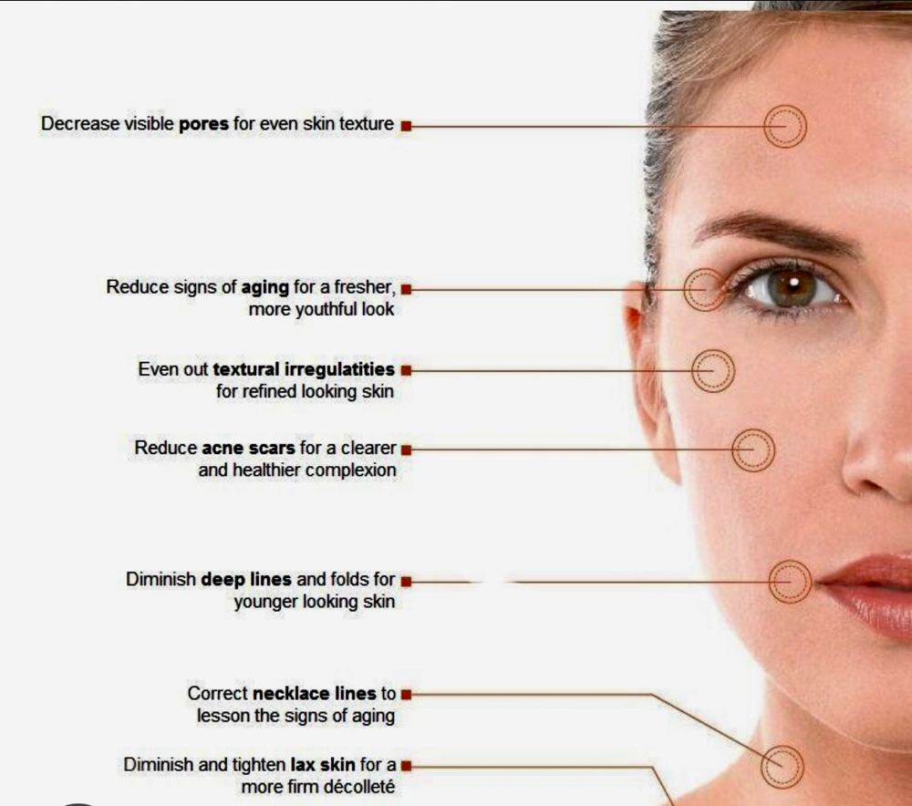 TRINITY INFRARED SKIN TIGHTENING