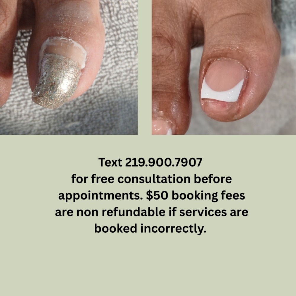 Ingrowns   (Overgrown Nails) at Chicago's Favorite Nail Spa in Lansing, IL