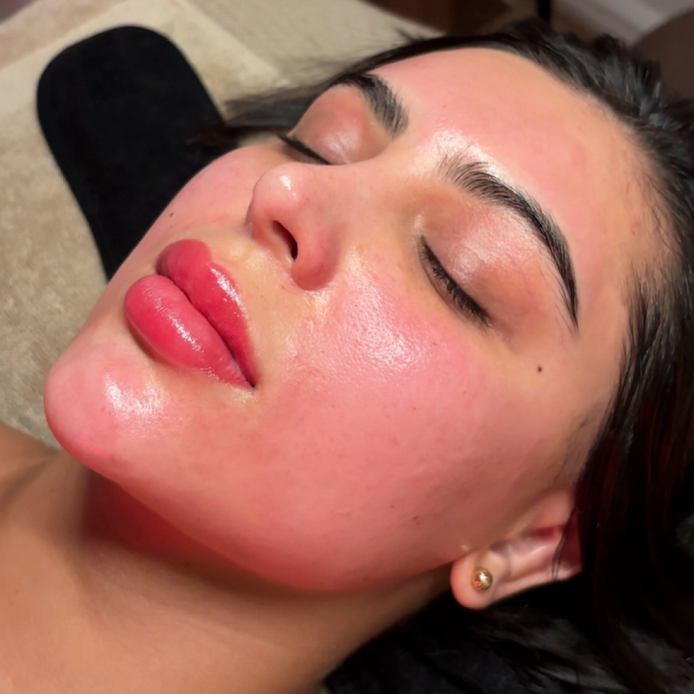 SIGNATURE GLASS SKIN FACIAL at FACE2FACE SKIN STUDIO in Kew Gardens, NY