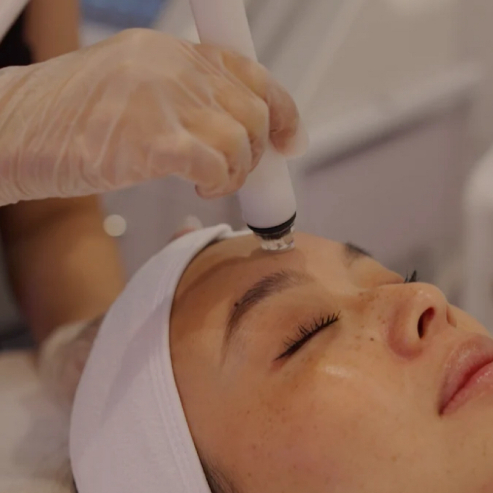Aqua Peel at Reborn beauty spa in Beverly, MA