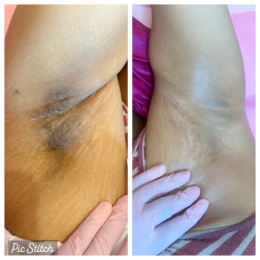 Underarm Wax