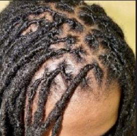 Retwist & Interlock (251-300)