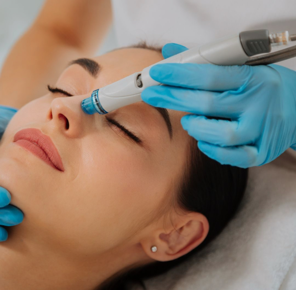 Hydra-dermabrasion Facial at Serene Studios in Sigel, IL