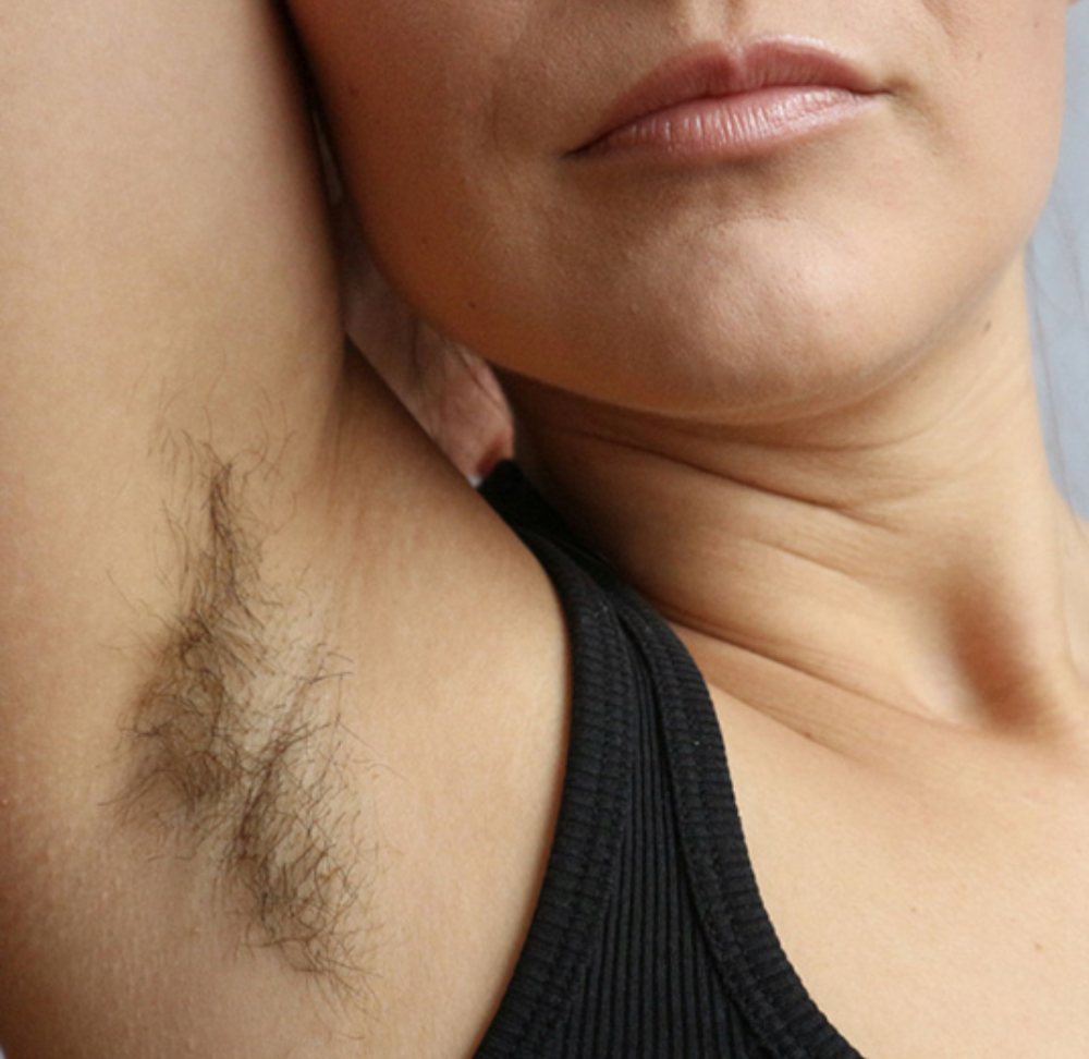 Underarms at SOLO BEAUTY SALON in Elizabeth, NJ