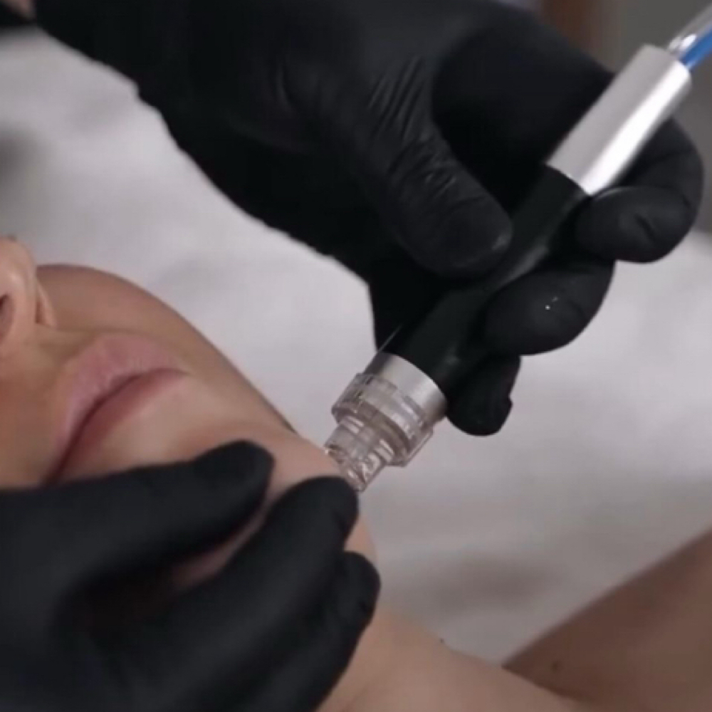 HydroFacial Diamond Glow