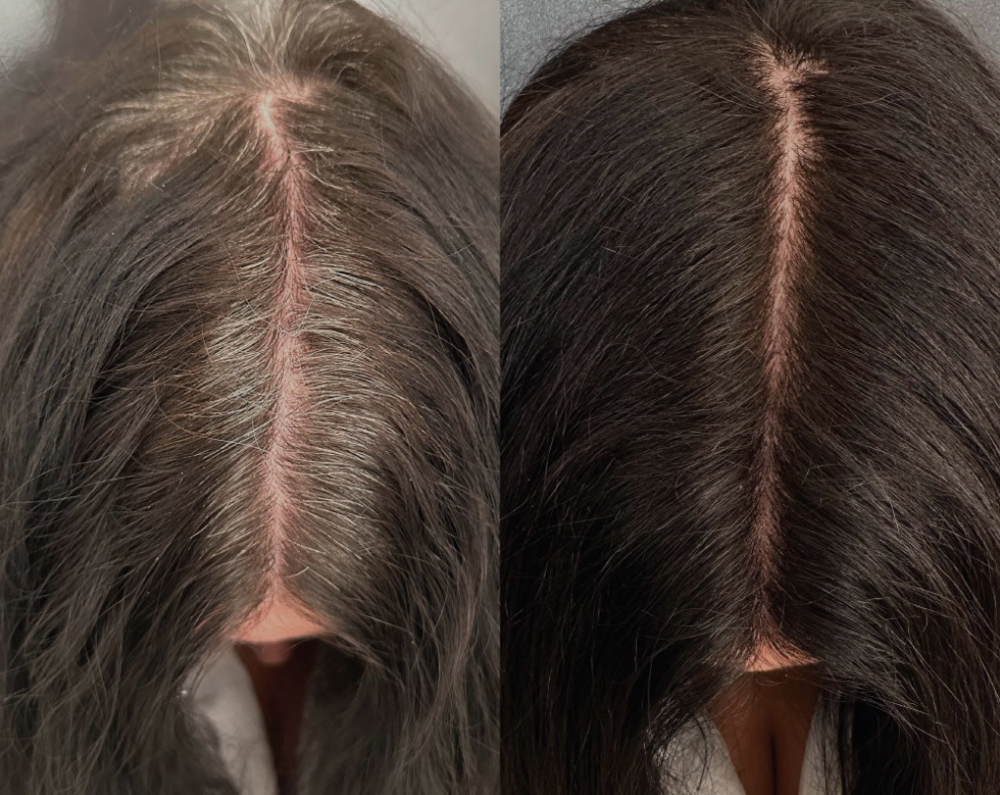 Express Root Touchup