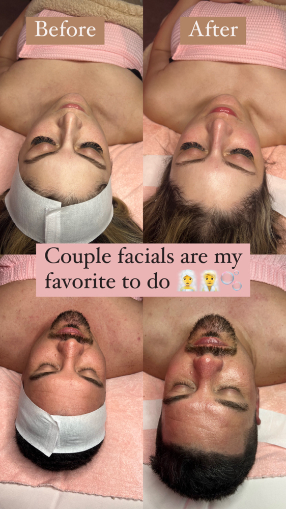 Couples Detox Facial