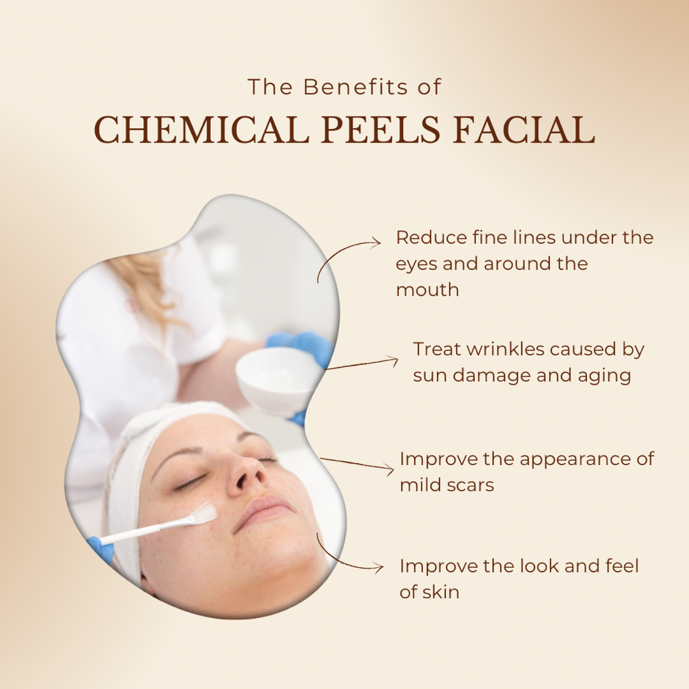 Chemical Peel