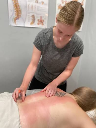 Running Cupping at Body Wellness Massage in Fort Stockton, TX