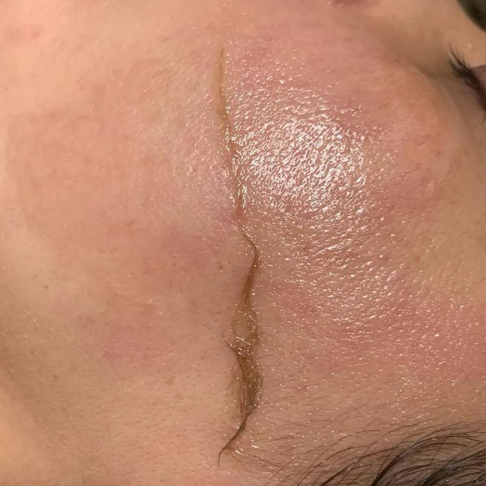 Add on Dermaplaning at Vanessa Renee Esthetics in Easley, SC