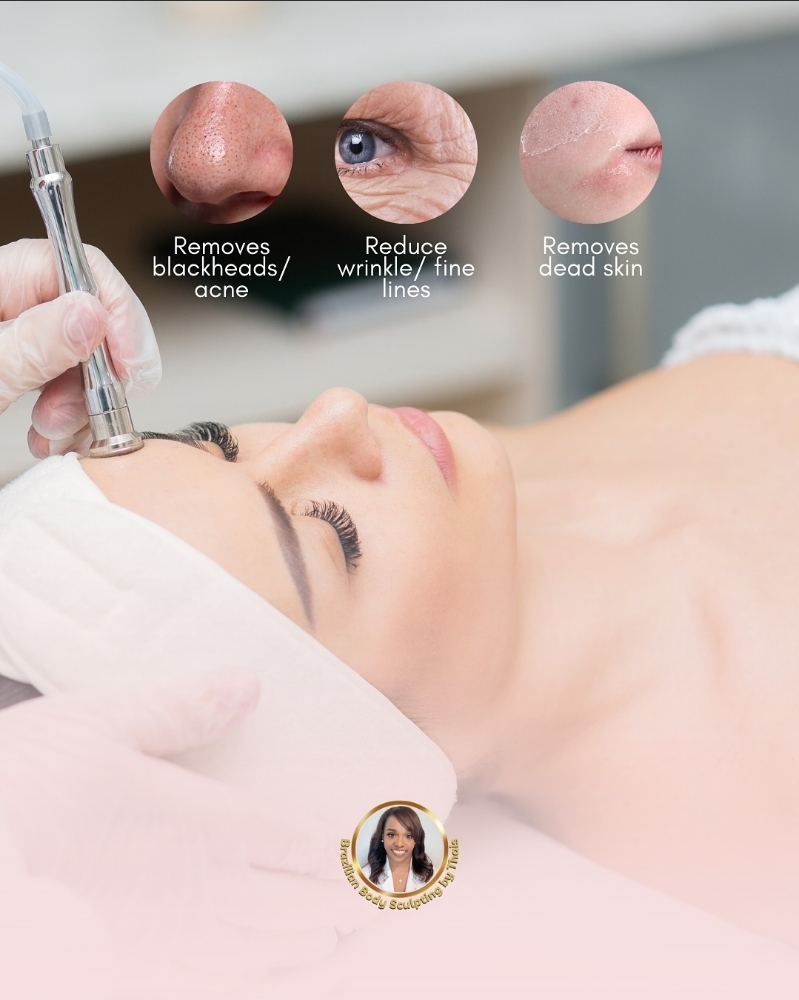 Diamond Microdermabrasion Facial