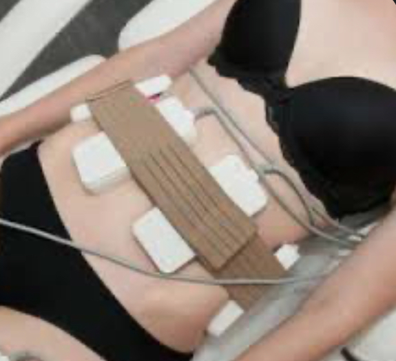 Pris-ision Sculpte Tier2: Melt&Tone