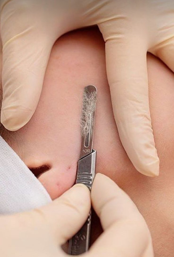 Dermaplaning Facial at Dejate Querer Skincare Studio in Northridge, CA