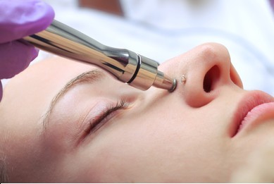 Add-on Diamond Microdermabrasion