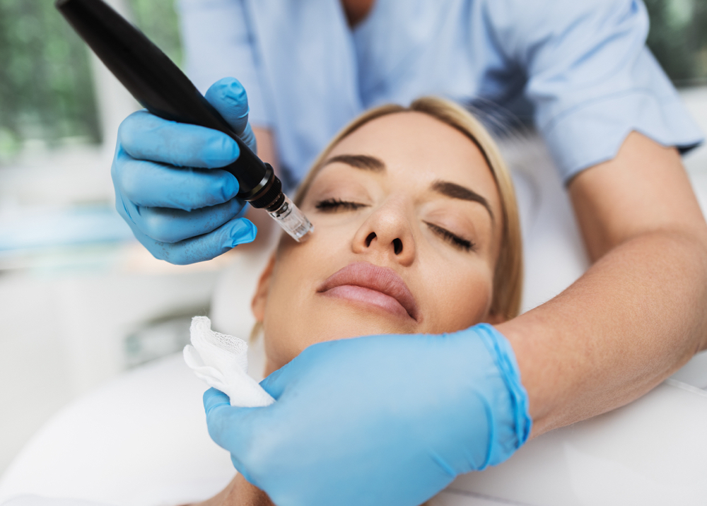 Microneedling + Hyaluronic Acid