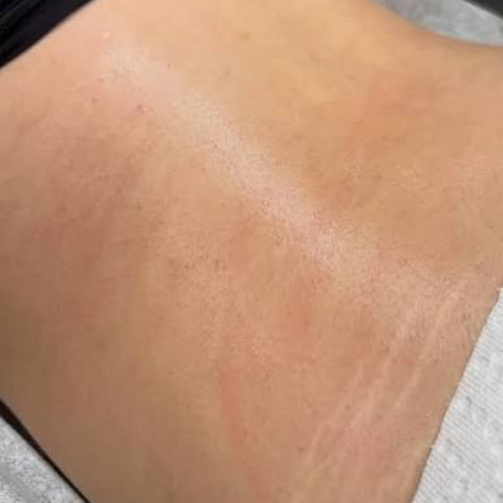 Lower Back at iSugar Waxing Studio in Redondo Beach, CA