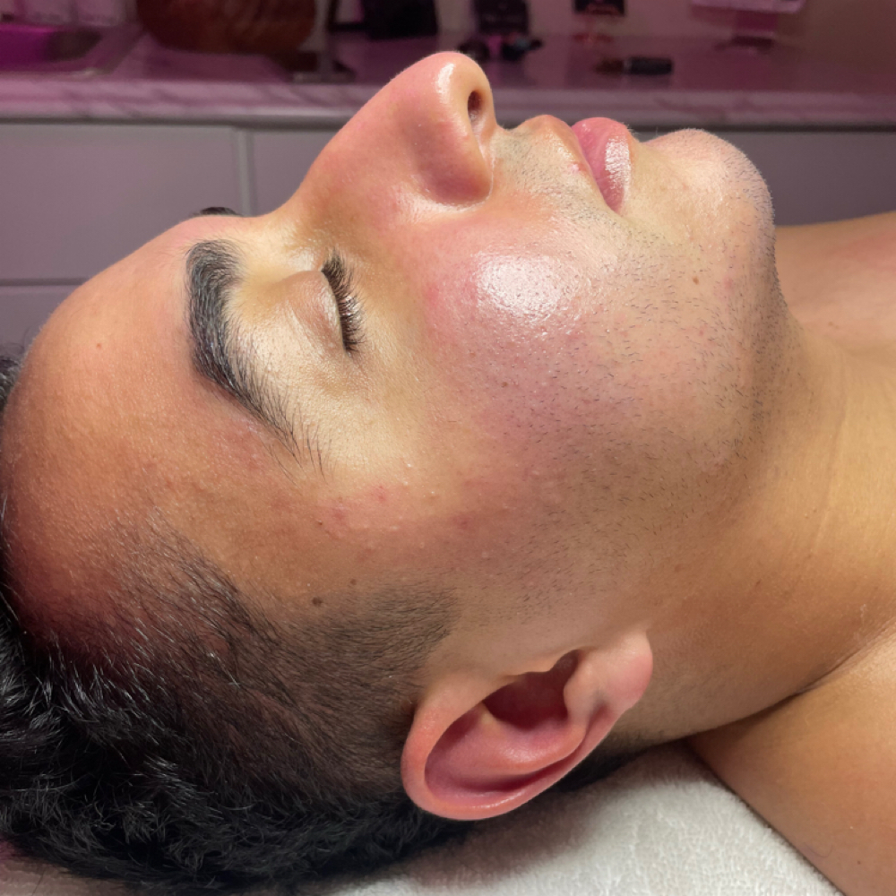 Men Get Facials Too at Divine Skin Esthetics in San Diego, CA