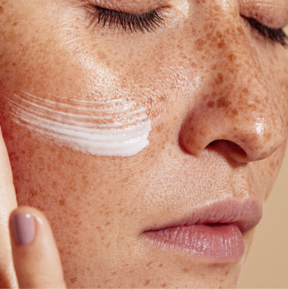 Depigmentation Peel at GlowDerm Clinic in San Jose, CA