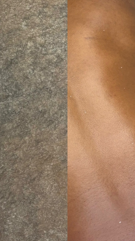Back Wax
