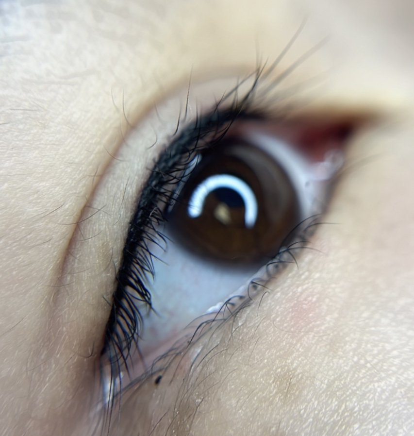 Lash Line Enhancement