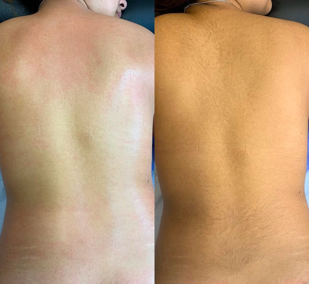 Full Back Wax
