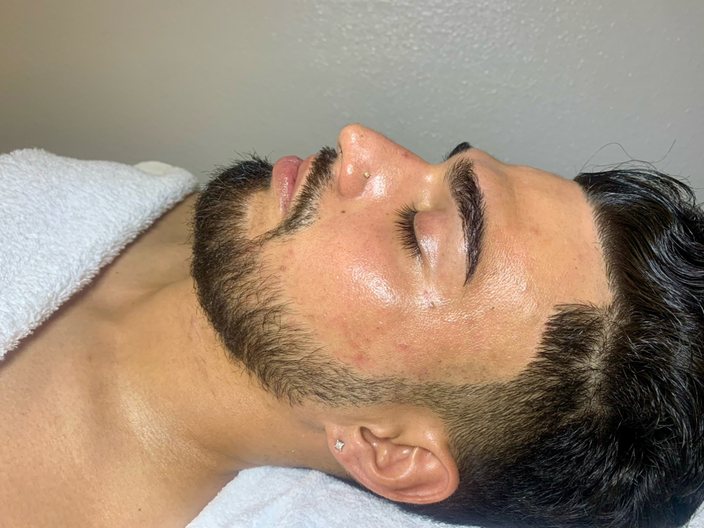 Dermaplaning Facial