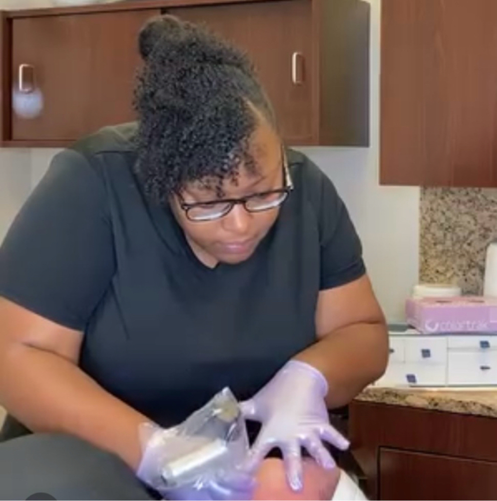 Microchannel Reset Treatment✨