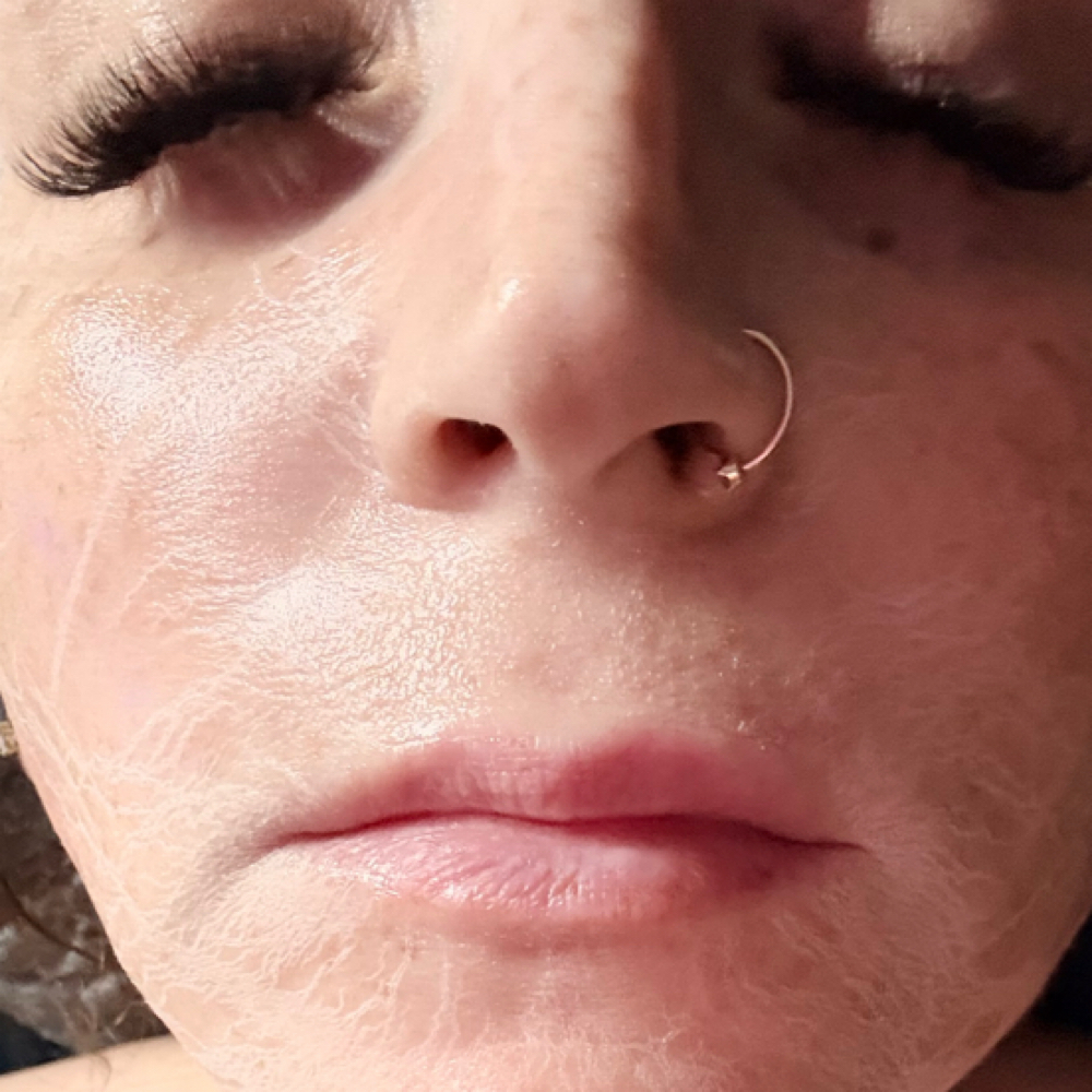 Glow Revival treatment at The Studio in Great Bend, KS