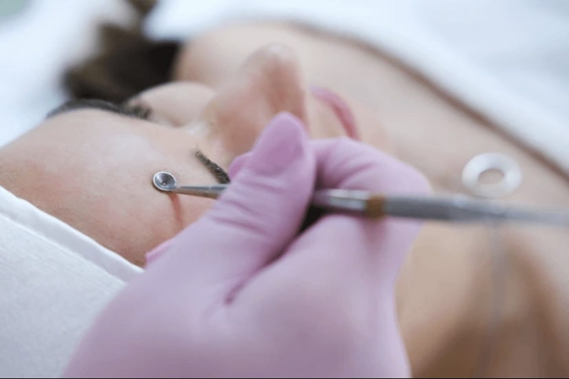 Extractions Add On