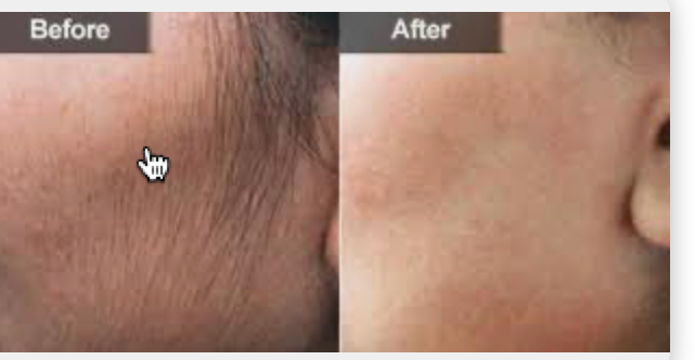 Full Face Wax