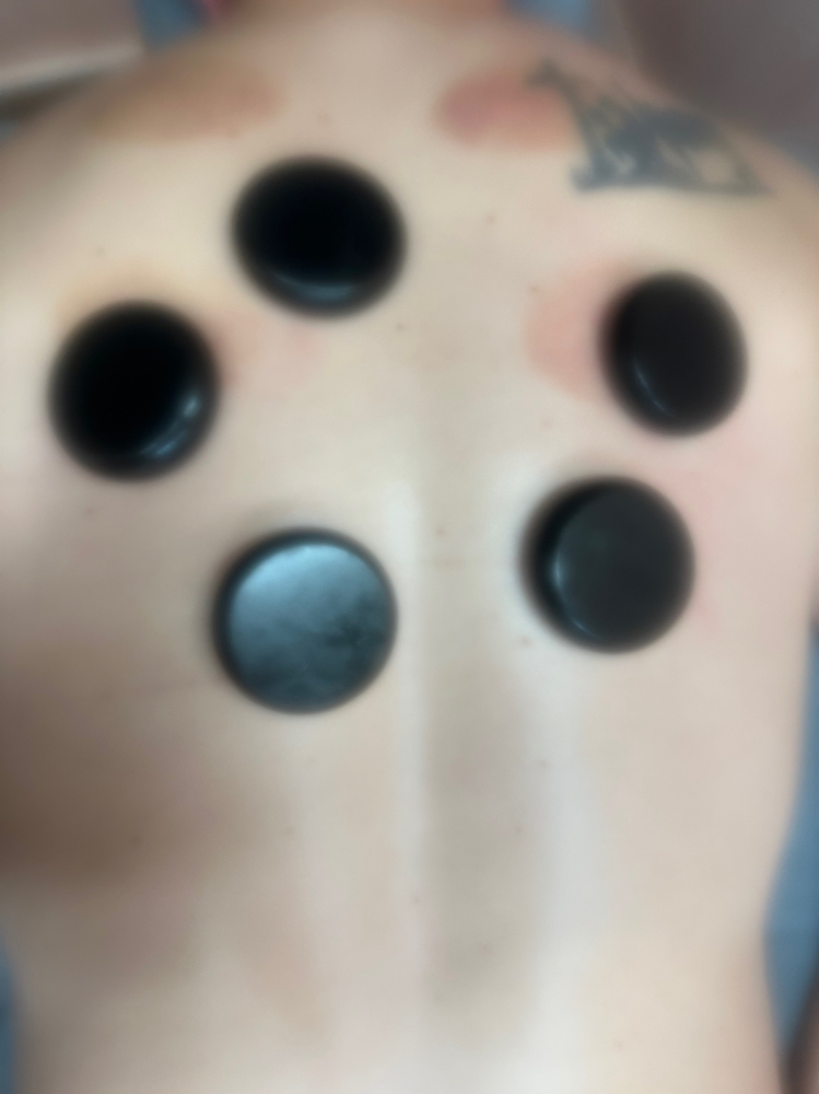 Hot Stone Hilot