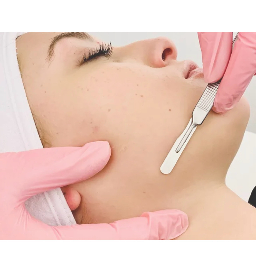 Dermaplane Add On