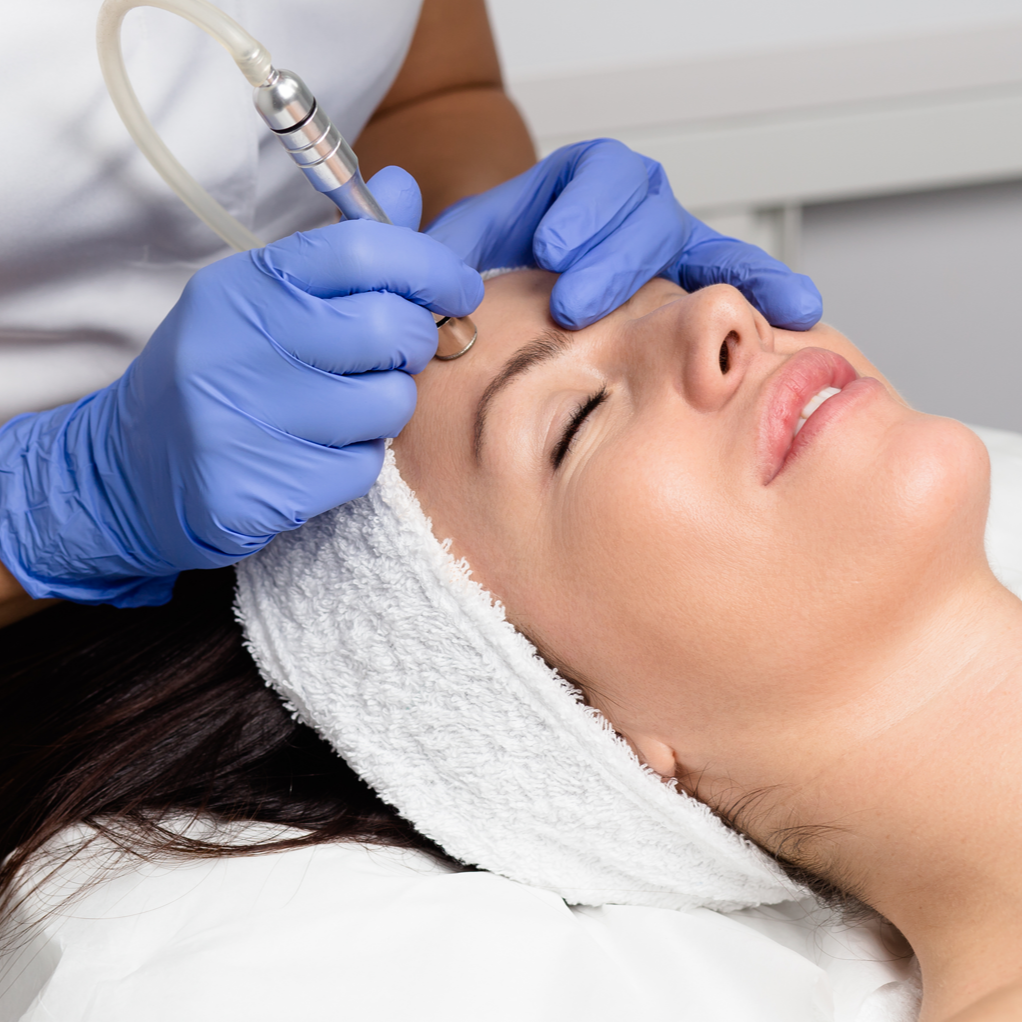 Microdermabrasion