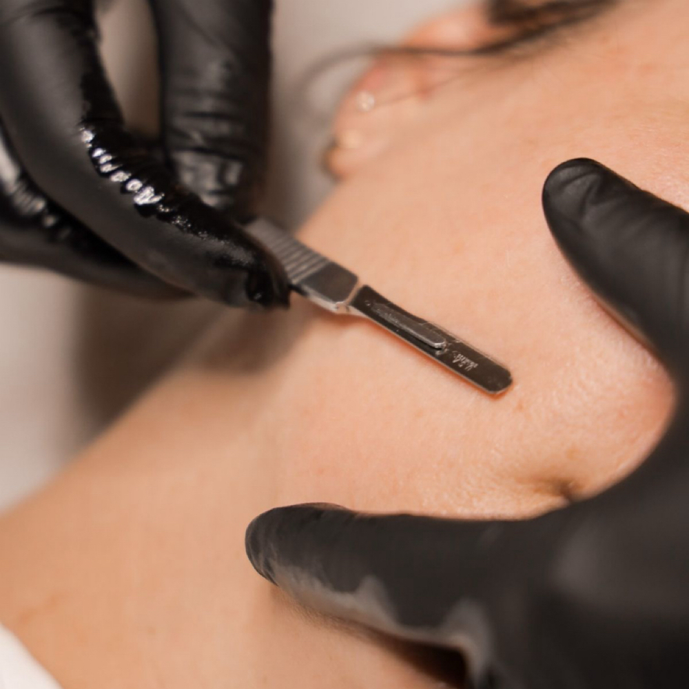 Dermaplane at Erika Esthetics in Russellville, AL