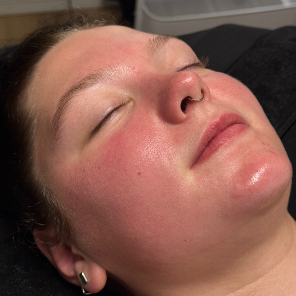 The Refinery Custom Treatment at Skin Refinery in Ozark, MO