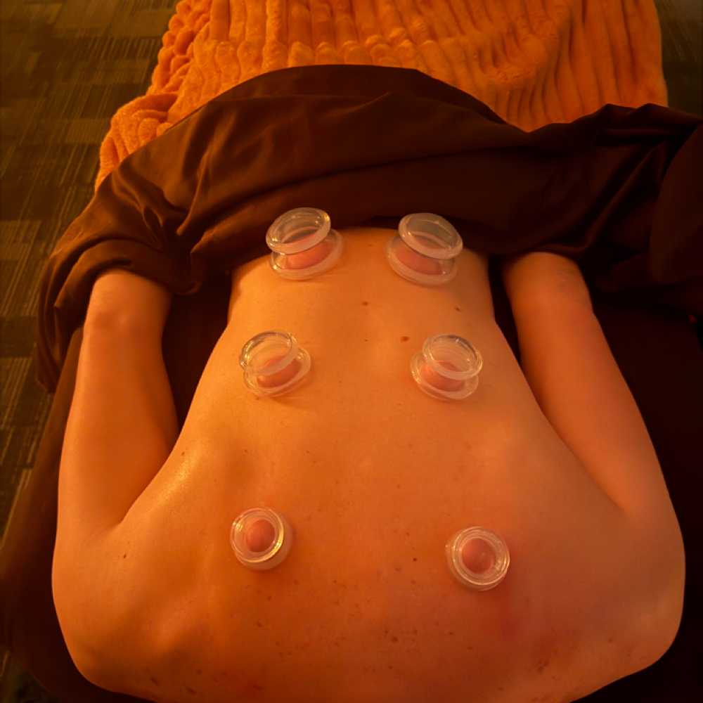 Cupping at Blissful Waves Massage LLC in Florence, KY