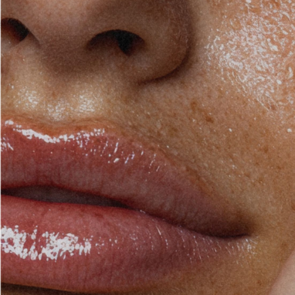 Lip Plumping at Arched in Studio City, CA