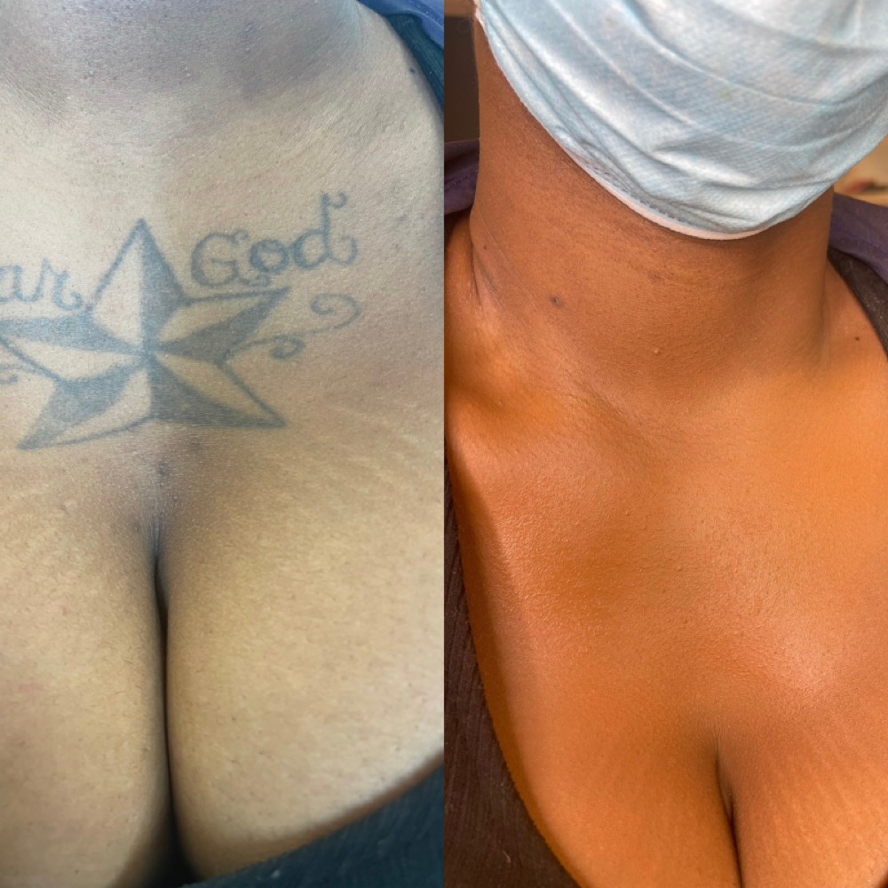 Tattoo Coverage Add-On at Glowed By Ginny in Atlanta, GA