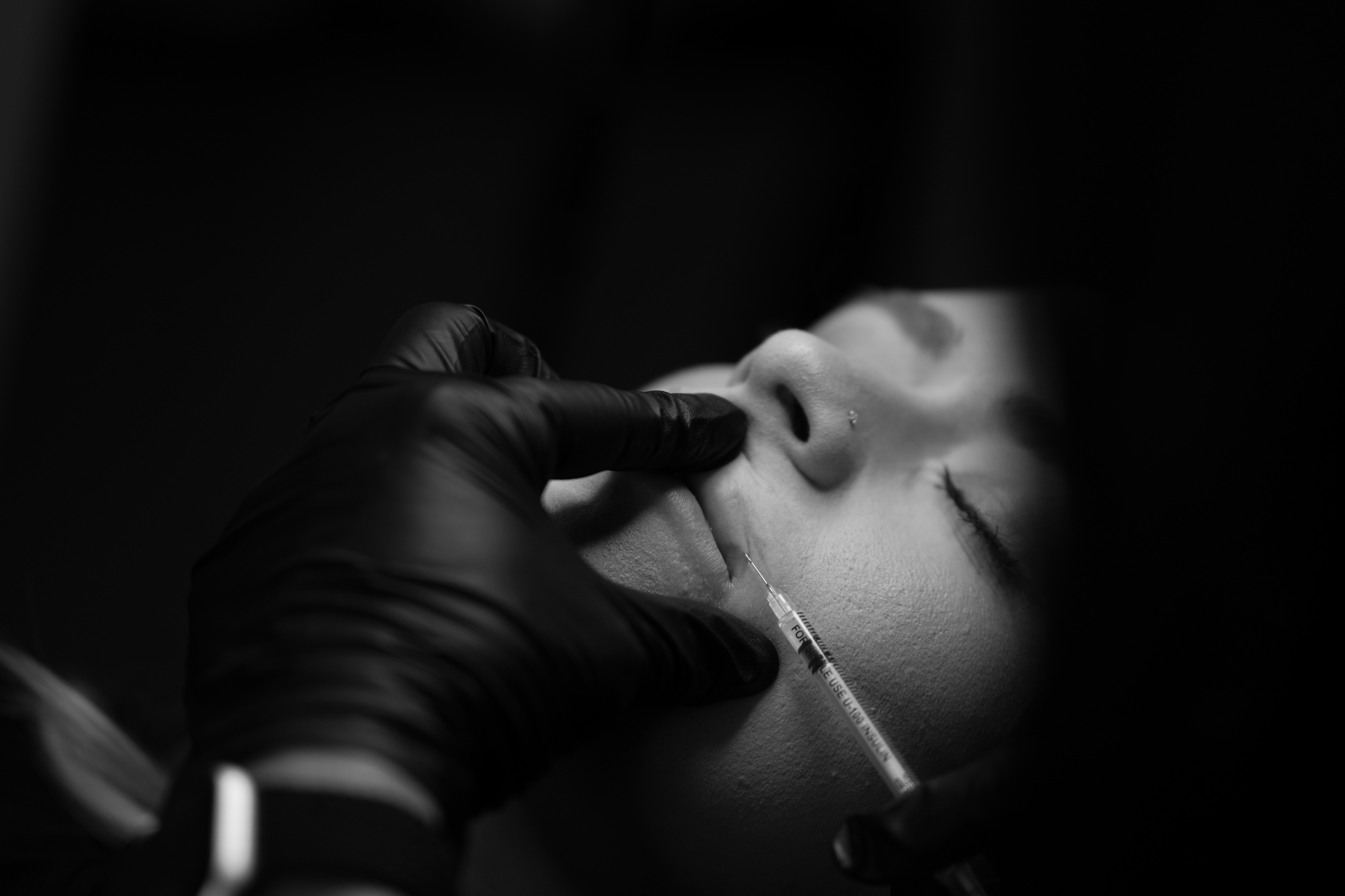 Lip Filler 1/2 Syringe at G5 Glamour in Pampa, TX