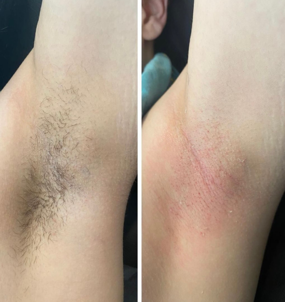 Arm/Armpit Wax