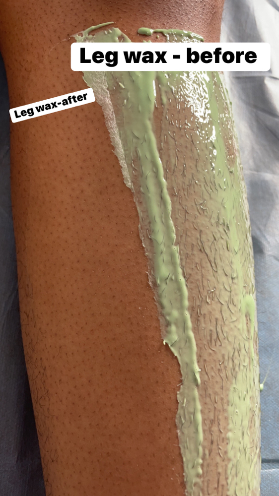Half Leg Hair Removal at Crowned Exclusive Esthetics in Kansas City, MO