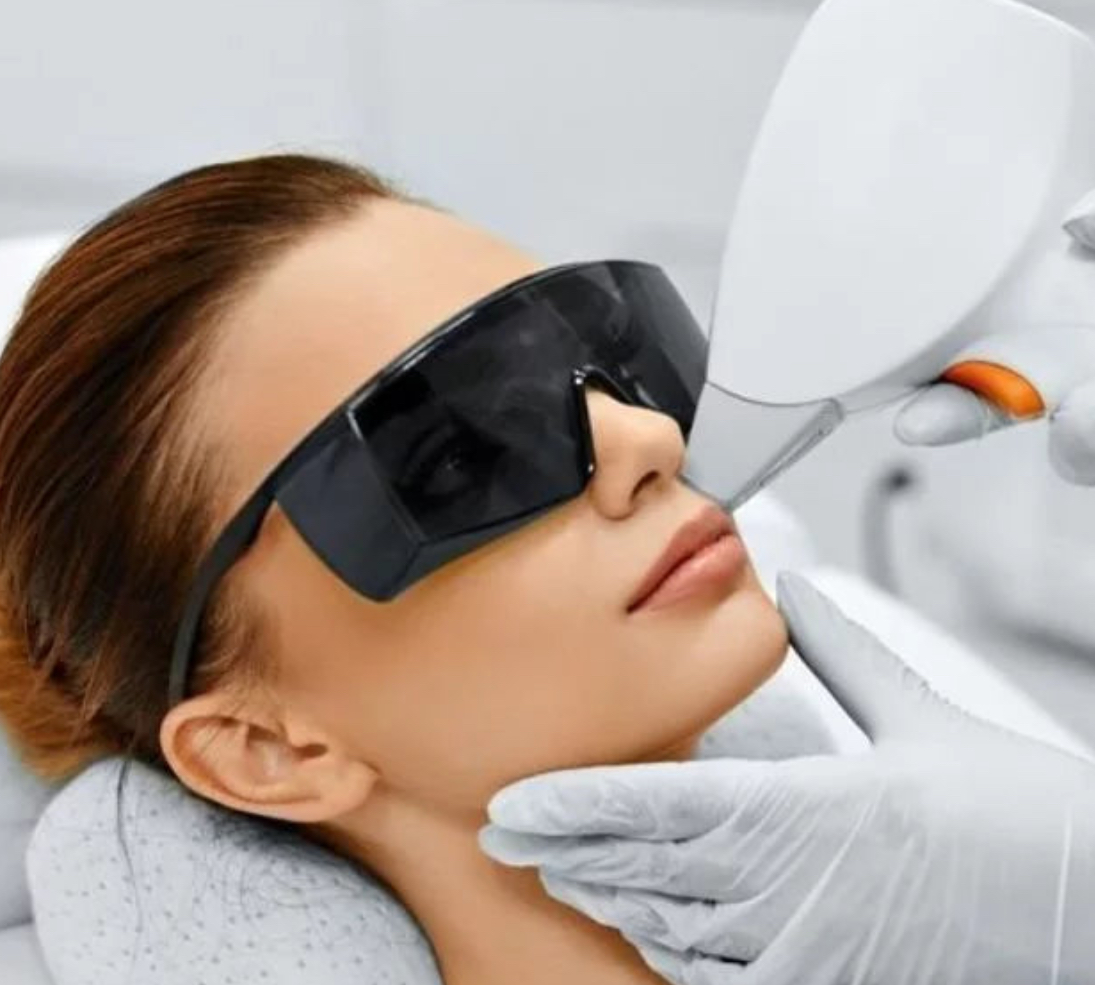 Laser Hair Removal Small area