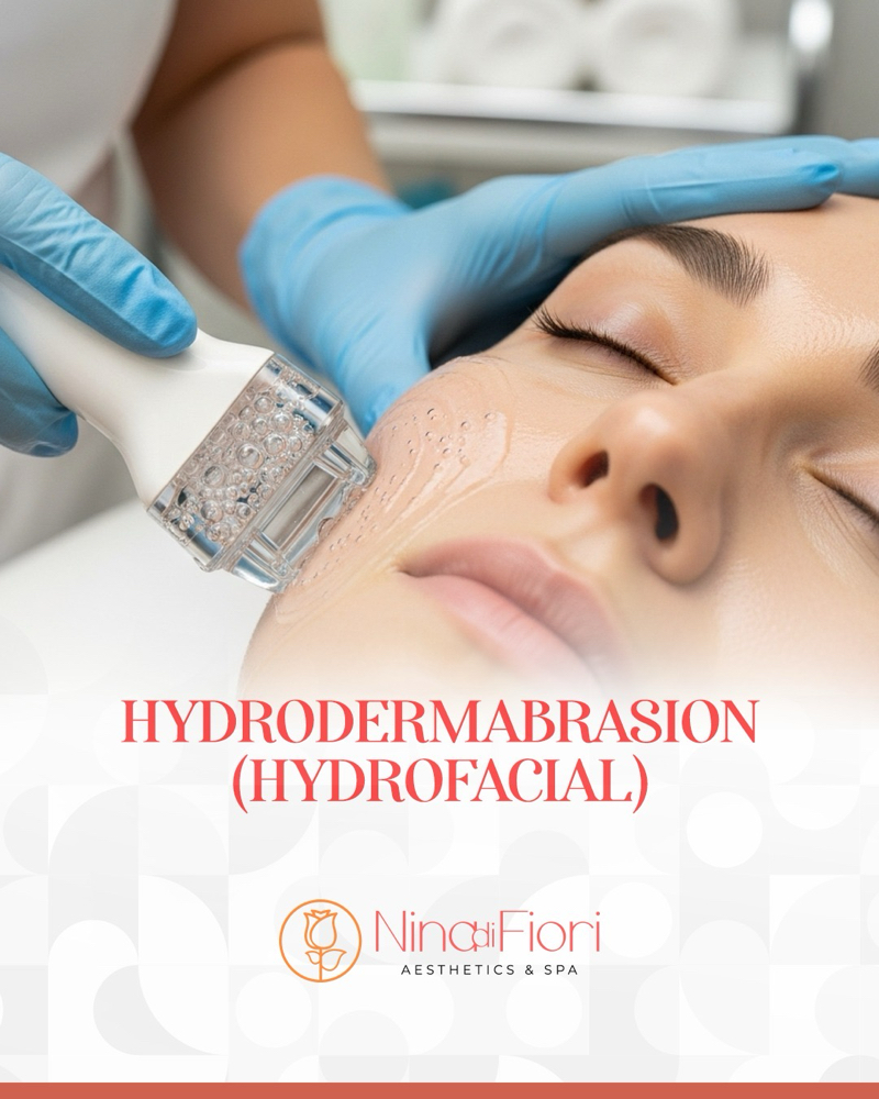 Hydrodermabrasion (hydrofacial)